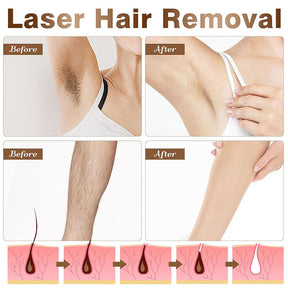 Permanent IPL Laser Hair Removal Device with LCD for Whole Body Use